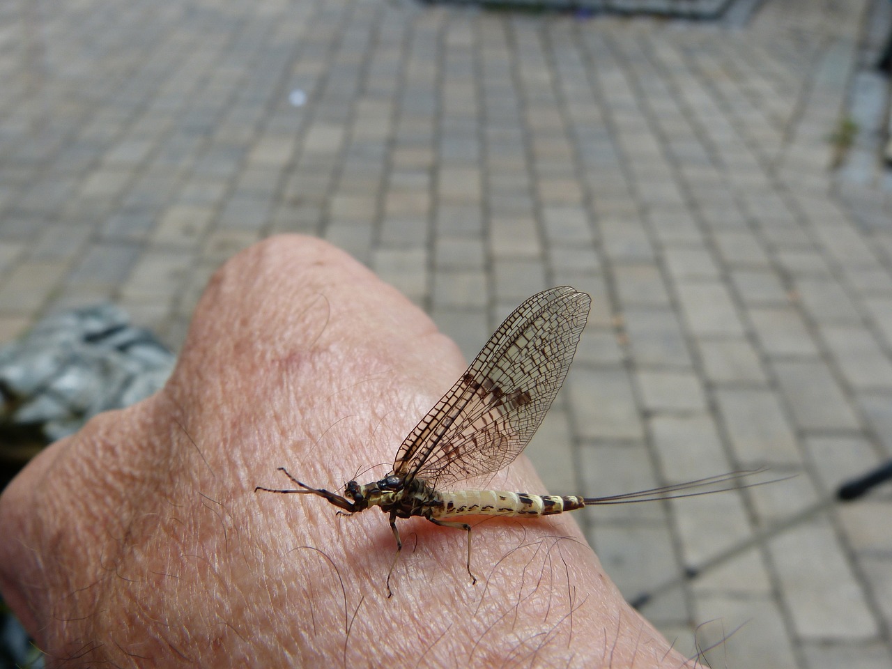 복부 거상